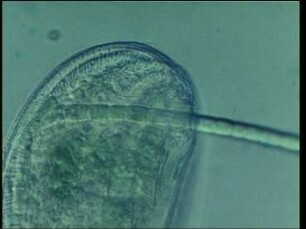 Food ingestion in Pseudomicrothorax