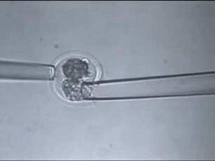 Biotechnik in der Fortpflanzung - Embryotransfer und Mikromanipulation beim Rind
