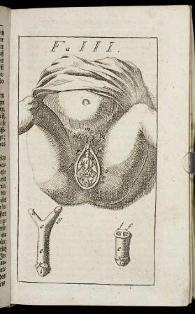 Figura III