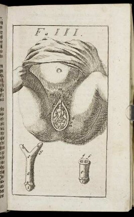 Figura III