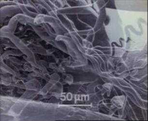 Structure of the Blood Vessels and Circulation of Blood in the Glomus caroticum of the Cat
