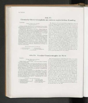 Abb. 114 Genuine Granularatrophie der Niere