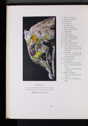 Figrur Nr. 254 Horizontalschnitt durch den Kopf in Höhe der unteren Nasenmuschel.