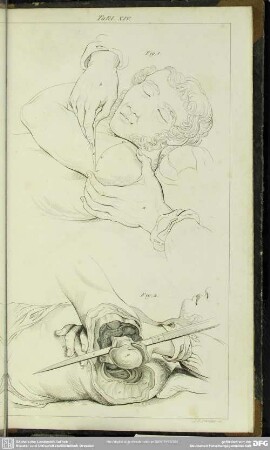 Tafel XIV