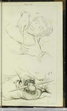 Tafel XIV