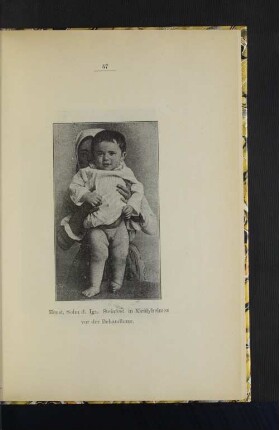 Ernst, Sohn d. Ign. Steinfest in Kiralyhelmez vor der Behandlung.