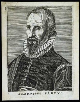 Paré, Ambroise