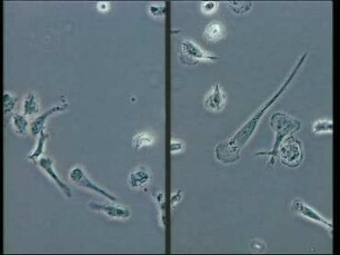 Macrophages - Differentiation of Human Monocytes into Macrophages in vitro