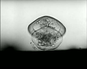 Arcella vulgaris var. multinucleata (Testacea) - Bewegung und Fortpflanzung