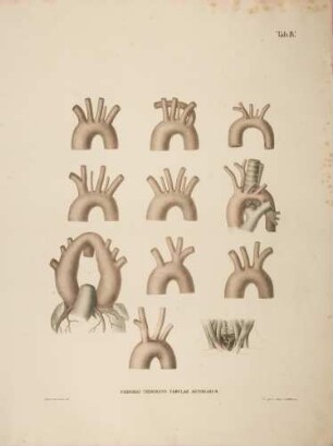Bogen der Aorta und Arterien