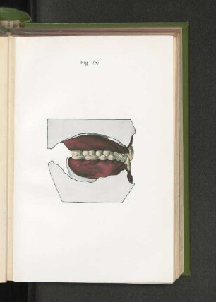 Fig. 257.