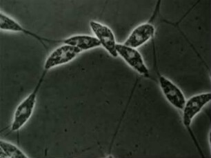 Labyrinthula coenocystis (Protomyxidea) - Bewegung und Fortpflanzung