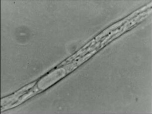 Fusarium solani (Fungi Imperfecti) - Intranucleäre Mitose