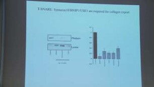 Building a machine at endoplasmic reticulum for collagen export