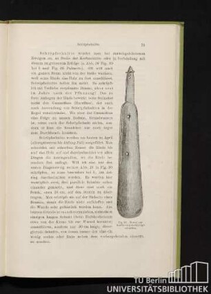Fig. 32. Messer zur Ausführung von Schröpfschnitten.
