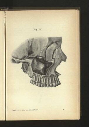 Fig. 22.