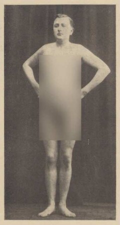 Fotografie einer zu Musterung in Trauerkleidung erschienenen Person (hier unbekleidet) (2)
