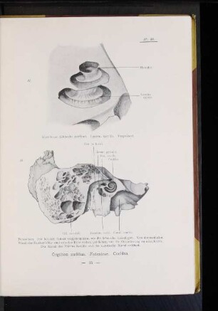 Organon auditus. Fenestrae. Cochlea.