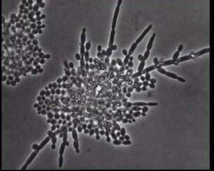 Cryptococcaceae (Imperfekte Hefen) - Vegetative Vermehrung bei Candida