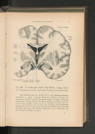 Fig. 64. Frontalabschnitt durch das Gehirn, knapp hinter der Commissura anterior und dem Foramen interventriculare.