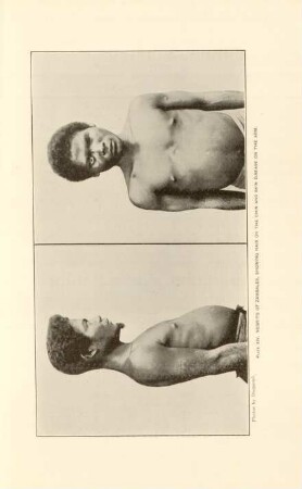 Plate XIV. Negrito of Zambales, showing hair on the chin and skin disease on the arm