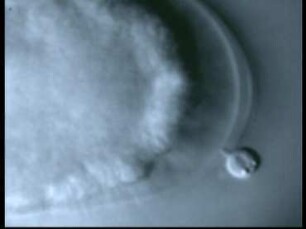 Infection of Nematodes by Zoospores of Catenaria anguillulae