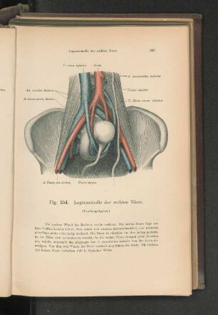 Fig. 354. Lageanomalie der rechten niere.