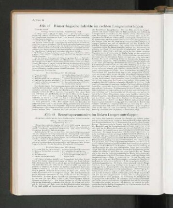 Abb. 47 Hömorrhagische Infarkte im rechten Lungenunterlappen