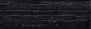 [Graphical recordings: pulse]
