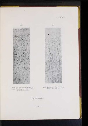 Cortex cerebri.