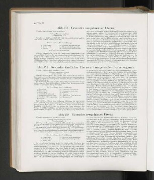Abb. 153 Gesunder neugeborener Uterus