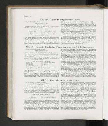 Abb. 153 Gesunder neugeborener Uterus
