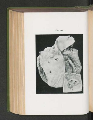 Fig. 123.