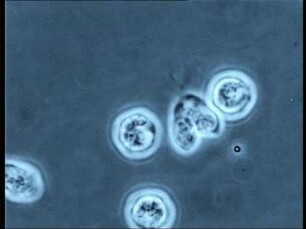 Geschlechtliche Fortpflanzung der Grünalge Hydrodictyon reticulatum