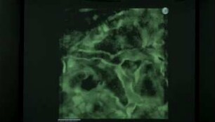 Near-physiological Microfluidic Models of Leukocyte Behavior: Challenges and Some Solutions