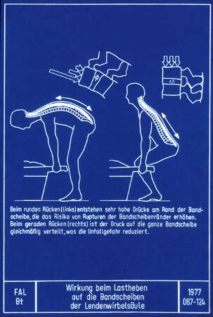 Wirkung beim Lastheben auf die Bandscheiben der Lendenwirbelsäule