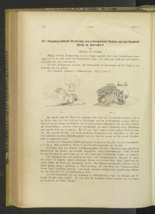 Die röntgenographische Darstellung des subskapularen Raumes und des Schenkelhalses im Querschnitt.