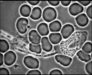 Leukozyten (Homo sapiens) - Phagozytose von Bakterien