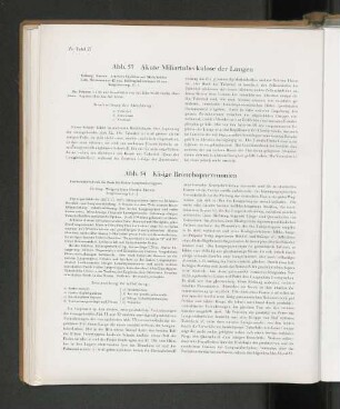 Abb. 53 Akute miliartuberkulose der Lungen