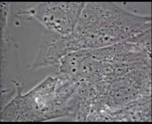 Mäusefibroblasten - Morphologische Veränderungen unter Einwirkung von Ektromelievirus (Mäusepocken)
