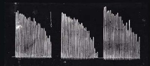 [Graphical recordings: fatigue]