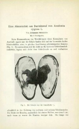 Eine Abnormität am Darmkanal von Anodonta cygnea L.