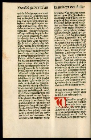 Czu dem achten folget vonn den geheylten an henden unnd fussen.