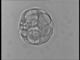 Entwicklung beim Seeigel (Psammechinus miliaris) - 1. Befruchtung und Furchung