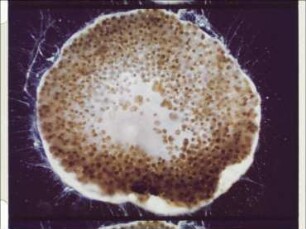 Heterostegina depressa (Foraminifera) - Vielteilung