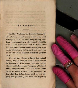 Über die Zögerung der Nachgeburt