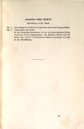 Atlas zur chirurgischen Anatomie und Operationslehre : 136 Tafeln in Stahlstich und 52 lithogr. Umrisstafeln ... gezeichnet v. Jor. Greb. 4