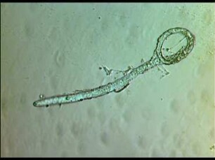 Humorale Einkapselung von Hydromermis contorta und Turbatrix aceti (Nematoda) in Haemolymphe von Chironomus thummi (Diptera)