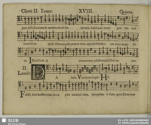 XVIII. II. Lamentatio: Daleth viae Sion lugent