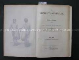 Die krankhaften Geschwülste. Dreißig Vorlesungen, gehalten im Wintersemesters 1862-1863 an der Universität zu Berlin, Bd. 1
